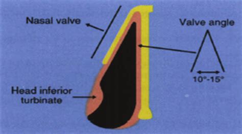Angle Of Internal Nasal Valve And Determination Of Middle Nasal Vault