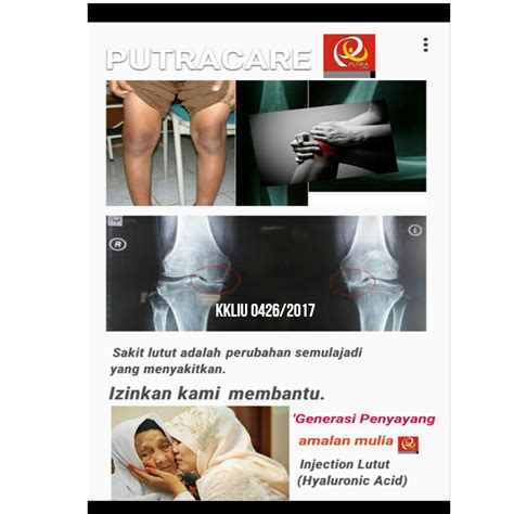 Cara mengobati nyeri sendi lutut / sakit lutut secara alami | wayahe herbal assalamualaikum. Rawatan Yang Boleh mengurangkan sakit lutut. - Klinik Putra