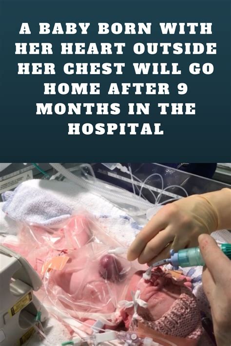 Baby Girl Born With Heart Outside Her Chest Had 10 Chance Of Survival