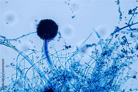 Aspergillus Niger And Aspergillus Oryzae Mold Under Microscope For