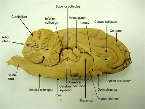Sagittal Section Lateral Ventricle Sheeps Brain Classroom