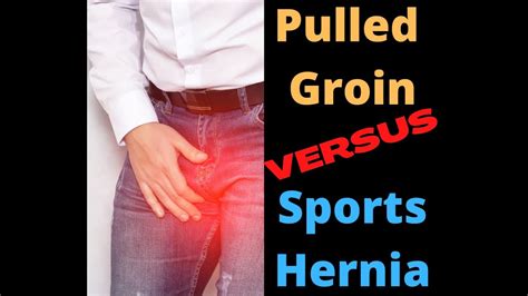 Pulled Groin Versus Sports Hernia Total Performance Physical Therapy