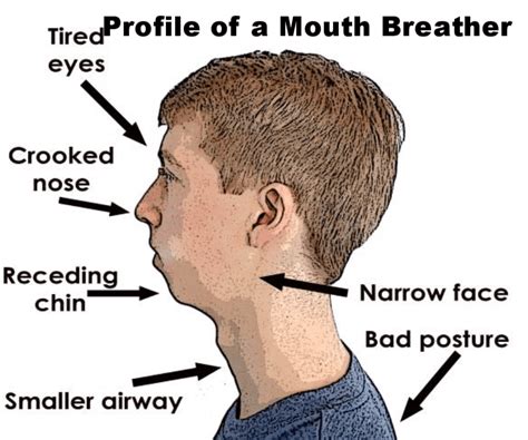 Mouth Breathing And Facial Development Rnosebreathing