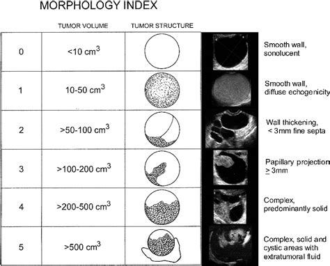 The patient may feel an abdominal mass. PDF Ultrasound Monitoring of Extant Adnexal Masses in ...