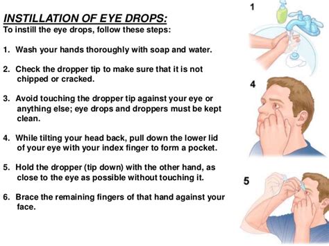 We use eye drops daily for not only comfort, enhanced visual performance, and dry eye relief. Structure of eye and instillation of opthalmic sol. in eye ppt