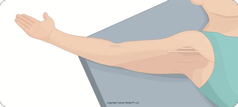 Cancer Rehab PT Your Guide To Getting Rid Of Axillary Web Syndrome