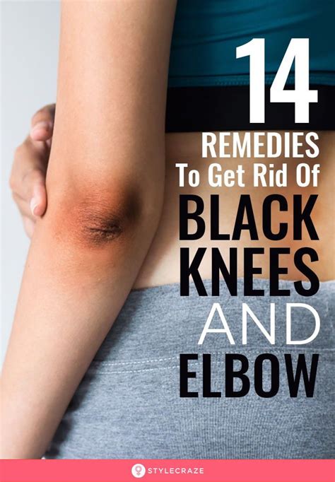 14 Home Remedies To Get Rid Of Black Knees And Elbow Best Diy Face Mask Dark Elbows Skin
