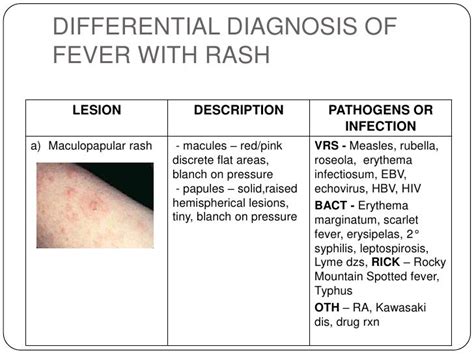 2 Fever With Rash