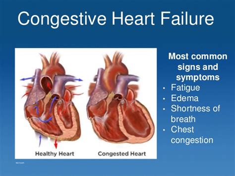 These conditions cause a range of symptoms. Congestive Heart Failure Case Study