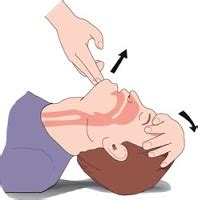There are some precautions for first aider to be. Head Tilt Chin Lift Technique