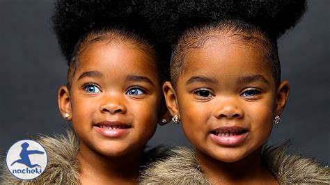 4 Beautiful African Girls With Blue Eyes Youtube