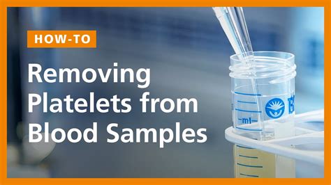 How To Remove Platelets From Human Blood Samples Prior To Cell