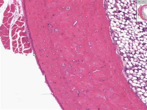 Histología de hueso cortical - YouTube