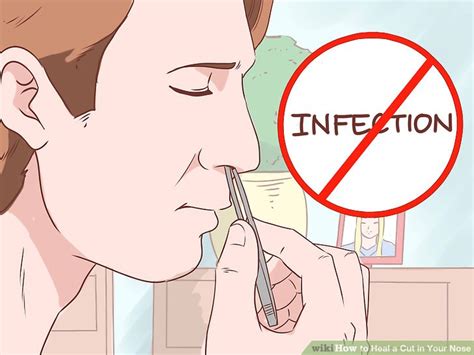 How To Heal A Cut In Your Nose With Pictures Wikihow