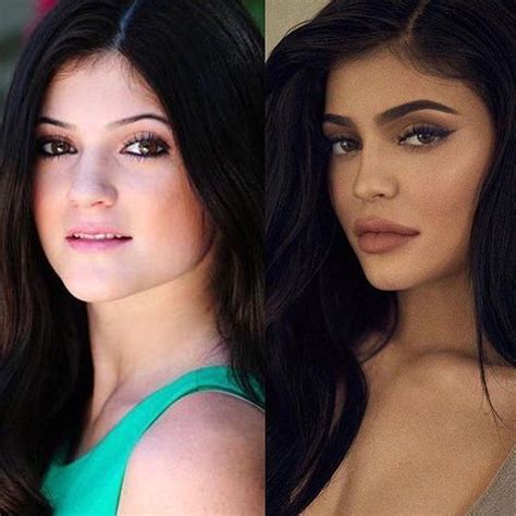 15 Celebs Who Have Had Plastic Surgery And Now Look Beautiful