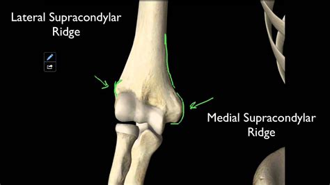 Treatment is nonoperative for the majority of fractures. 100 The Structures On The Distal Humerus - YouTube