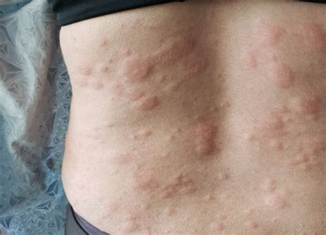 We did not find results for: Sering Muncul Tiba-tiba, 8 Tips Ini Bisa Kalian Coba Untuk ...