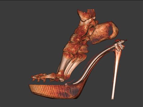 What Your Foot Really Looks Like In High Heels