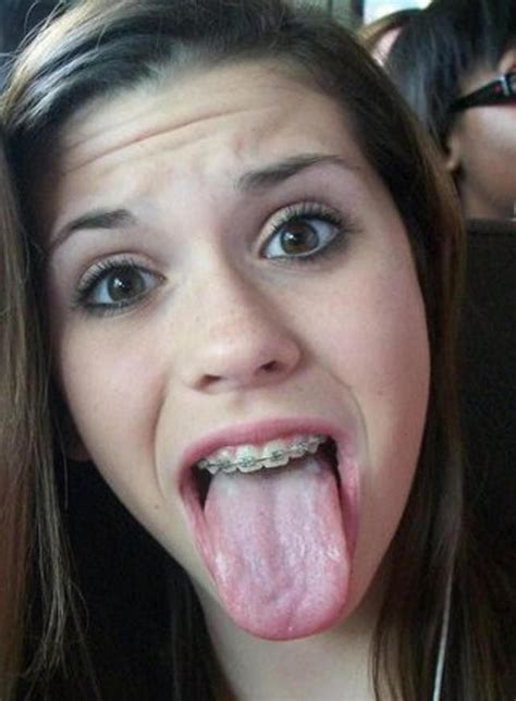 Teen Braces Tongue Mega Porn Pics