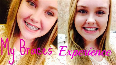 My Braces Experience Everything You Need To Know About Braces Youtube