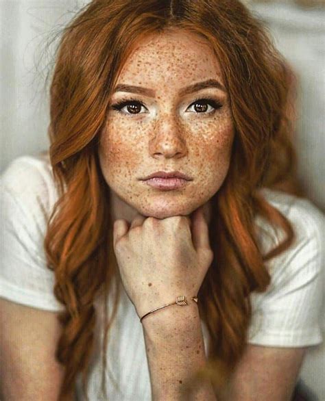 Rissii Ginger Ruivice Freckles Pecas Sardas Gingerpride Noirossi Shoutout Gingerlover