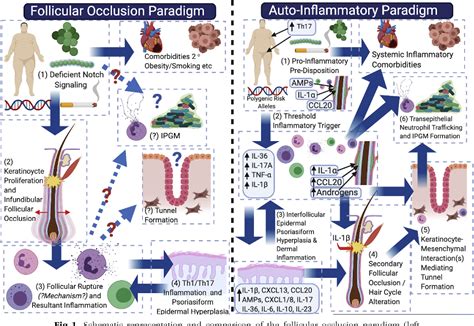 Figure 1 From Hidradenitis Suppurativa Is An Autoinflammatory