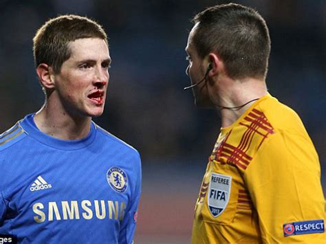 البوم صور اللاعب الأسباني فرناندو توريس fernando torres www.6line.net/index.php?option=com_content&view=artic. جولولي | بالصور.. فرناندو توريس بالقناع