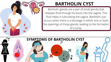 Best Homeopathic Treatment For Bartholin Cyst Treatment In Delhi Tamariaclinic