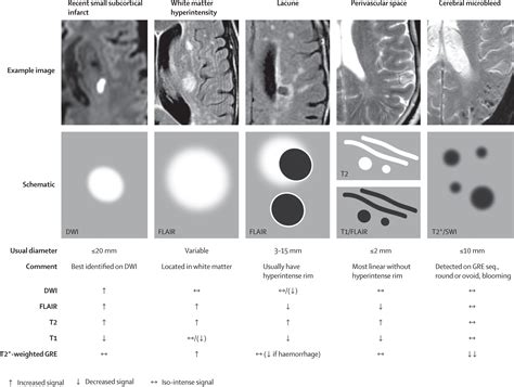 Neuroimaging Standards For Research Into Small Vessel Disease And Its