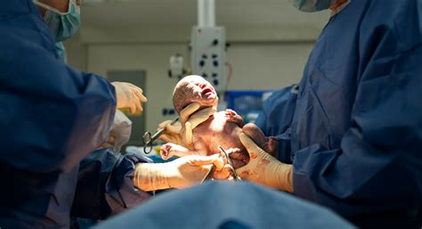 Why We Must Call Time On Damaging Anti Caesarean Birth Stigma The Independent