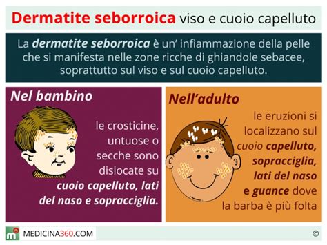 Dermatite seborroica su viso e cuoio capelluto: sintomi ...
