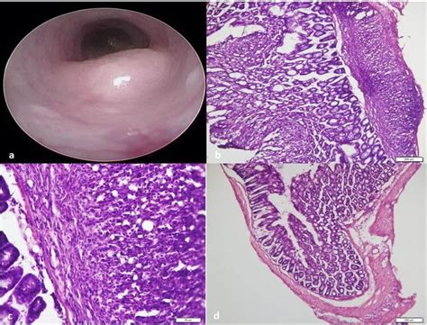 But rectal cancer is unique in its diagnosis and treatment. Endoscopic and histologic appearance of the rectal tumor ...