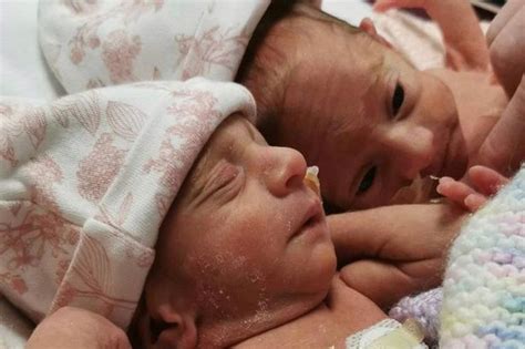 Adorable Premature Twins Born Cuddling With Tiny Arms Wrapped Around