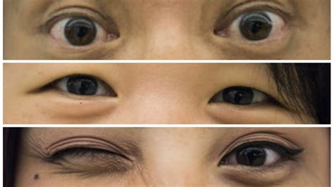 Olhos Japoneses Chineses E Coreanos