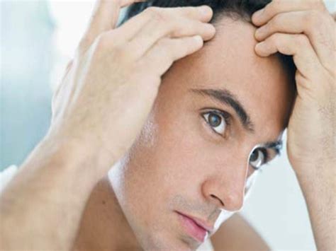 Important Things You Should Remember When Going For A Hair Transplant
