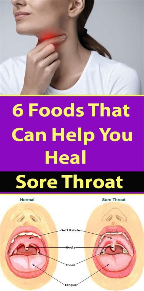 6 Foods That Can Help You Heal Sore Throat Foods For Sore Throat