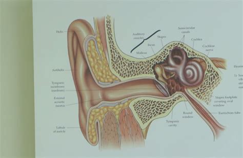 Keeping Your Ears Healthy Wgn Tv