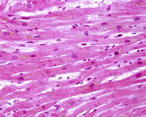 O Tecido Muscular Cardíaco Apresenta Fibras