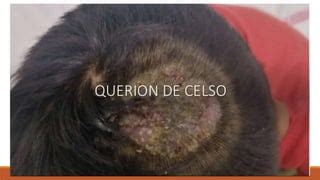 Querion De Celso Pptx Descarga Gratuita