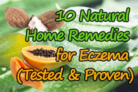 10 Natural Home Remedies For Eczema Tested And Proven Cure Eczema Slowly