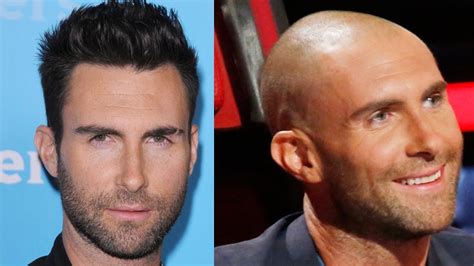 Famous People With Hair Loss 125 Best Haircuts For In 2020