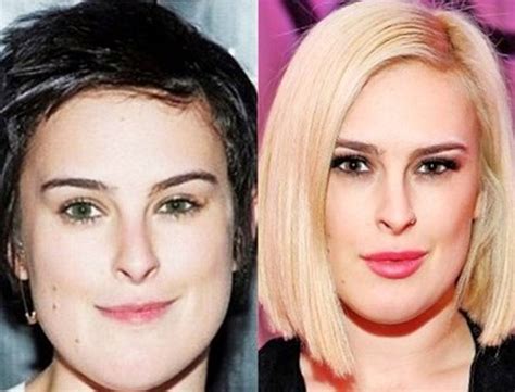 Searching For Perfection Rumer Willis Before And After Plastic Surgery