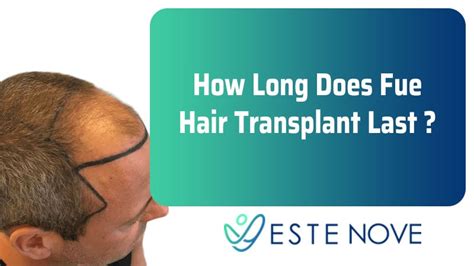 In theory, a hair transplant can last a lifetime because the hair follicles harvested for the procedure are genetically programmed to keep growing. How Long Does Fue Hair Transplant Last | EsteNove Hair ...