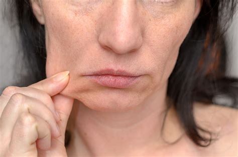 Woman Pinching The Skin Of Her Cheek Stock Photo Download Image Now