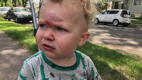 Baby Fell And Hit Head On Coffee Table Baby Hit Head What To Look For