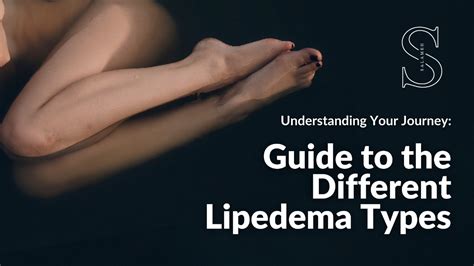 Understanding The Types Of Lipedema And Lippylipo Treatment