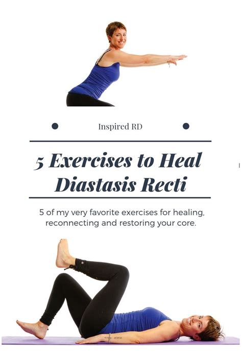 Fix Diastasis Recti 5 Things You Can Do Right Now Inspired Rd