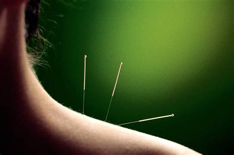 针灸, pinyin zhēnjiǔ, jyutping zam1gau3) ist eine behandlungsmethode der traditionellen chinesischen medizin (tcm). Ex Animo - Från hjärtat: Akupunktur - nej tack!