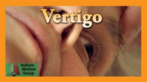 Epley - Peripheral Vertigo Positional Testing | Vertigo ...