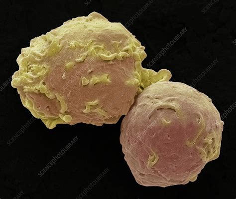 Human Monocytes Sem Stock Image C0200702 Science Photo Library